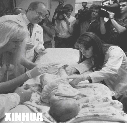 接受活性人体细胞和牛胶原蛋白合成皮肤移植的第一例病人（历史上今天lssjt.cn）