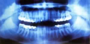 X射线公诸于世(历史上今天lssjt.cn)